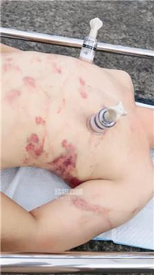 【黛樱】户外阳台重刑调-螃蟹夹乳 bf56757